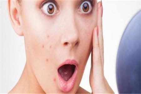 臉部各個地方長痘的原因和你的身體健康有關(guān)，如何解決有建議