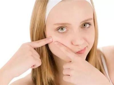 臉部各個地方長痘的原因和你的身體健康有關，如何解決有建議