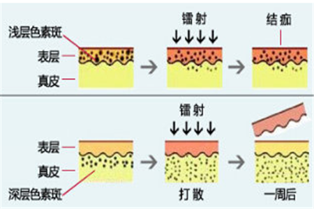如何有效改善混合型肌膚不好的狀態,除了正確護膚步驟,還有哪些-易網健康養生網 如何有效改善混合型肌膚不好的狀態,除了正確護膚步驟,還有哪些