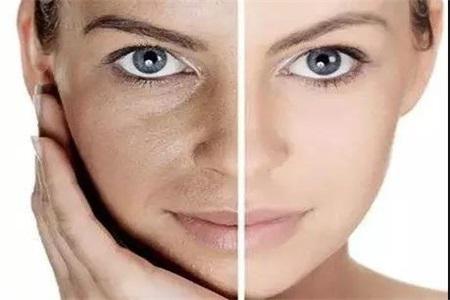 額頭長痘、下巴長痘，黑眼圈是怎么回事，原來都和這件事有關