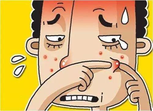 痤瘡不斷  收好這份戰“痘”書