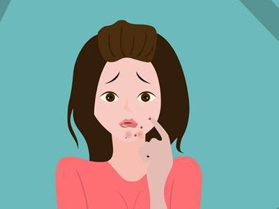 女性下巴長痘，原來是身體這里出問題，教你五招去除痘痘