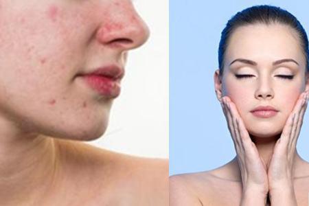 閉口是什么，它會(huì)慢慢自己消失嗎，去除閉口要靠這四招