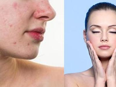 閉口是什么，它會慢慢自己消失嗎，去除閉口要靠這四招