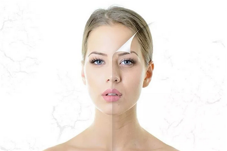 暗黃皮膚如何美白，三個美白方法擁有水嫩肌膚