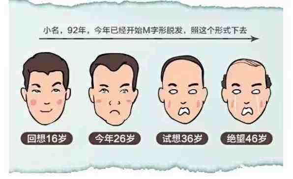 沒有家族脫發(fā)史 我為什么年紀(jì)輕輕也禿了