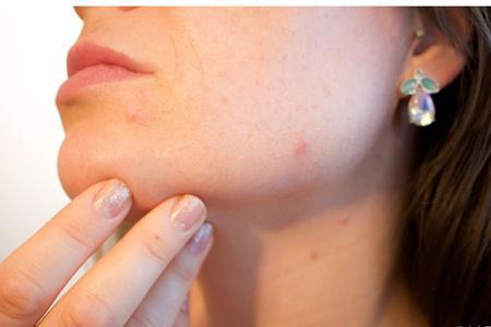 臉上七處長痘痘的位置圖解，一直長痘原來是這里出現(xiàn)毛病