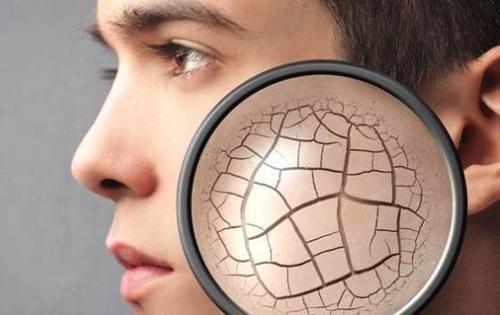 干性皮膚補水小妙招，學習快速補水的方法刻不容緩