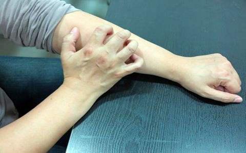 冬季皮膚瘙癢是怎么回事? 可能是6個(gè)因素在作怪-易網(wǎng)健康<a href=http://m.henggaotouzi.com/jkys/ target=_blank class=infotextkey>養(yǎng)生</a>網(wǎng) 冬季皮膚瘙癢是怎么回事? 可能是6個(gè)因素在作怪