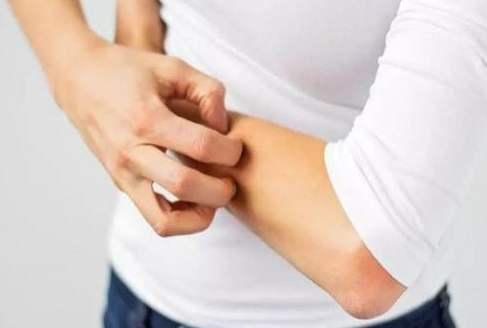 冬季皮膚瘙癢是怎么回事? 可能是6個(gè)因素在作怪-易網(wǎng)健康養(yǎng)生網(wǎng) 冬季皮膚瘙癢是怎么回事? 可能是6個(gè)因素在作怪