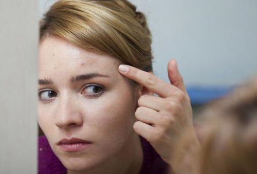 額頭長痘的原因及調理方法 杜絕痘痘橫行