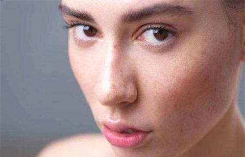 干性皮膚為什么容易長斑？色斑和皮膚干的聯(lián)系