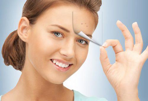 額頭長痘的原因及調理方法 杜絕痘痘橫行