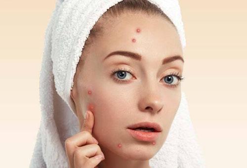 臉上的痘坑能去除嗎 簡單9招讓你擺脫“月球臉”