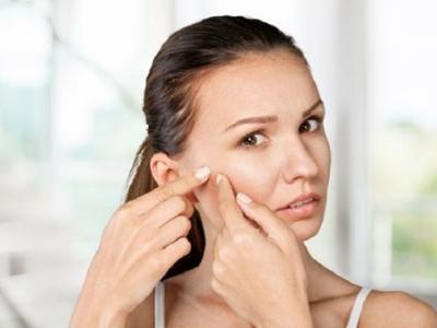 為什么不能用手擠痘痘？用手擠痘痘的危害