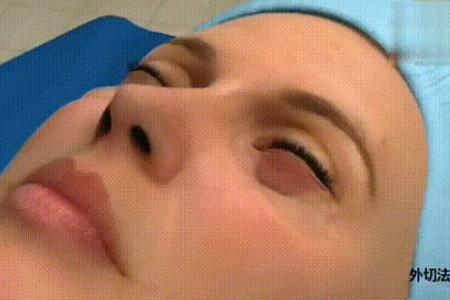 怎樣祛眼袋，讓眼袋消失無蹤的有效妙招