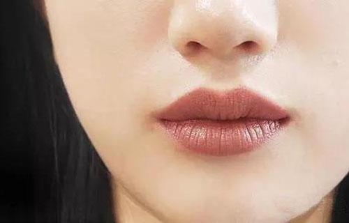 嘴唇邊緣顏色深如何淡化？淡化唇色的方法