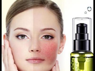 敏感肌爽膚水怎么挑 這3點需要注意