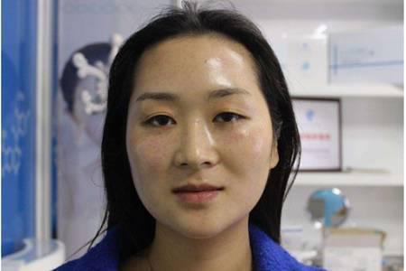 玻尿酸原液的作用和使用方法，女性天天用玻尿酸的后果