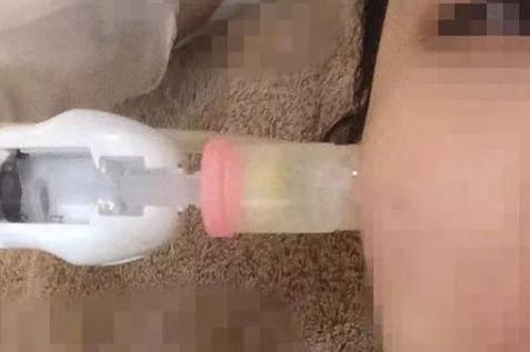 微針和水光針有什么區別？哪個治療效果會更好