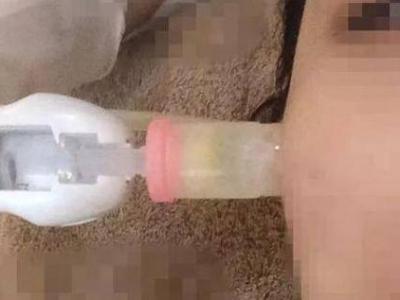 微針和水光針有什么區(qū)別？哪個治療效果會更好