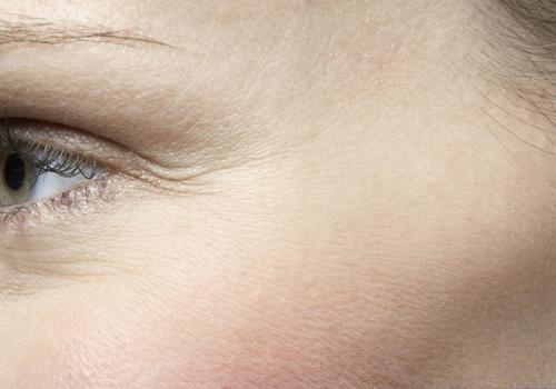 怎樣消除眼部細紋 做到這幾點有效改善細紋