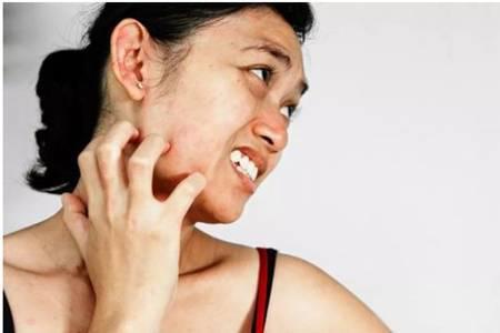 臉過敏發紅癢怎么辦，緊急護膚方法保濕消紅腫