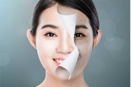 女生油性皮膚怎么改善,防曬才是最重要的控油方法-易網<a href=http://m.henggaotouzi.com/ target=_blank class=infotextkey>健康養生</a>網 女生油性皮膚怎么改善,防曬才是最重要的控油方法