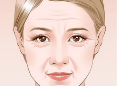 怎樣做能預防皺紋的出現 4個護膚好習慣get起來