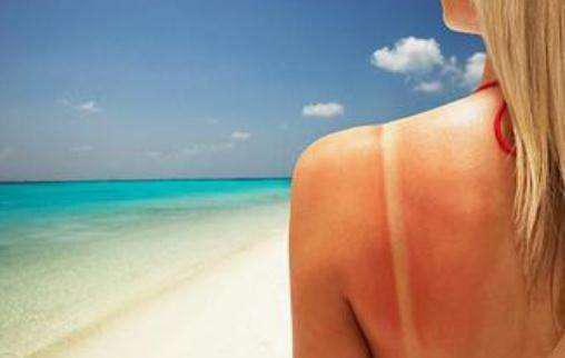 皮膚曬傷后蛻皮怎樣妥善處理 6個(gè)妙招幫你快速修復(fù)-易網(wǎng)<a href=http://m.henggaotouzi.com/ target=_blank class=infotextkey>健康養(yǎng)生</a>網(wǎng) 皮膚曬傷后蛻皮怎樣妥善處理 6個(gè)妙招幫你快速修復(fù)