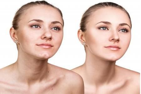 女生額頭長痘痘是什么原因，一按就痛要怎么調理