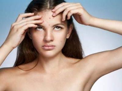 敷面膜第二天長痘的原因是什么  3個誘發臉上痘痘緣故大伙兒需注意