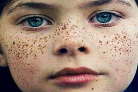 怎么樣可以淡化色斑  5個淡化色斑的方法簡單易學(xué)