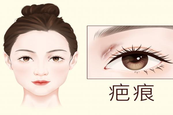 疤痕皮膚修復方法-易網健康<a href=http://m.henggaotouzi.com/jkys/ target=_blank class=infotextkey>養(yǎng)生</a>網 疤痕皮膚修復方法