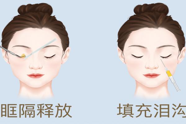 整容都包括哪些項目-易網<a href=http://m.henggaotouzi.com/ target=_blank class=infotextkey>健康養生</a>網 整容都包括哪些項目