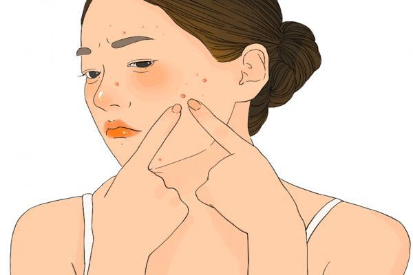 臉上的痘坑怎么修復