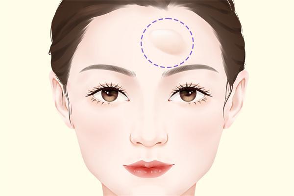 額頭有皺紋怎么回事