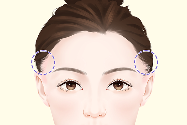 油脂性脫發該怎么辦-易網<a href=http://m.henggaotouzi.com/ target=_blank class=infotextkey>健康養生</a>網 油脂性脫發該怎么辦