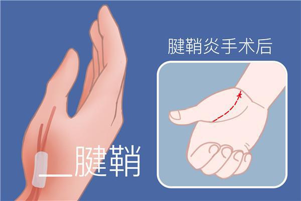 疤痕皮膚修復方法-易網<a href=http://m.henggaotouzi.com/ target=_blank class=infotextkey>健康養(yǎng)生</a>網 疤痕皮膚修復方法