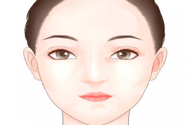 什么是激素臉,怎么造成的