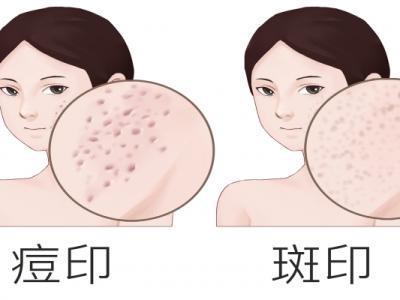 彩光祛斑的效果