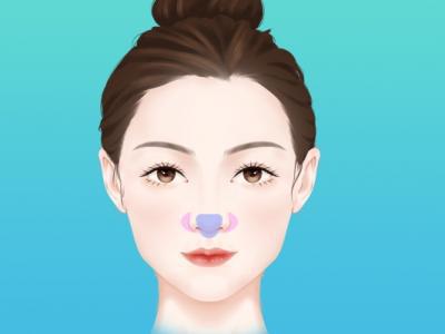 如何做臉部填充
