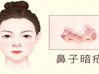 臉色暗沉發黑怎么才能變白