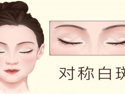 皮膚白斑