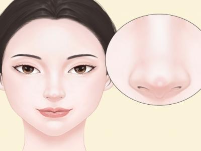 隆鼻可以只隆鼻梁不隆鼻尖嗎