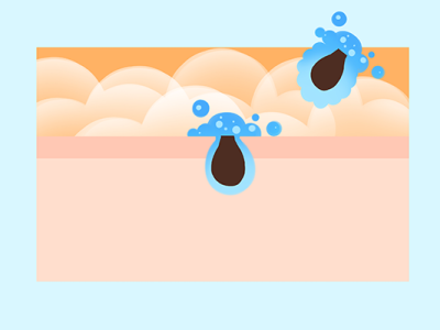 毛孔粗大如何治療?
