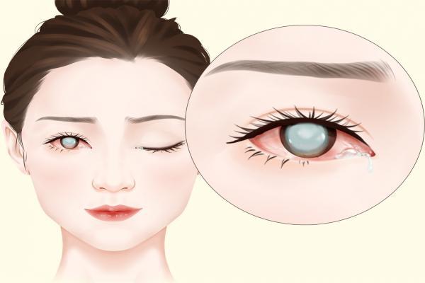 眼部抗衰老的幾個方法