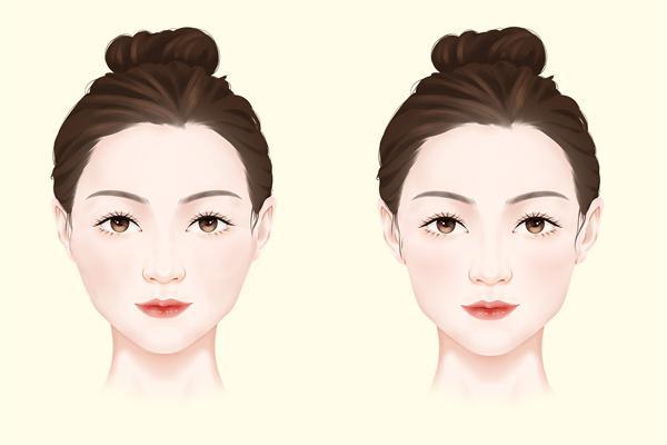 瘦臉針要打多少次