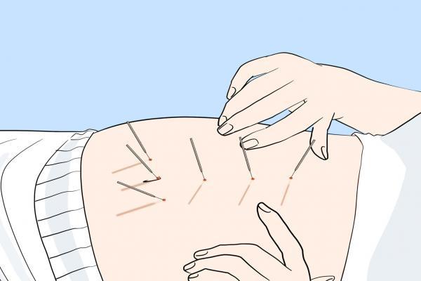 醫美瘦小腿的方法