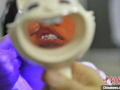 瘋狂的牙套：“9塊9包郵”就能實現整牙自由？